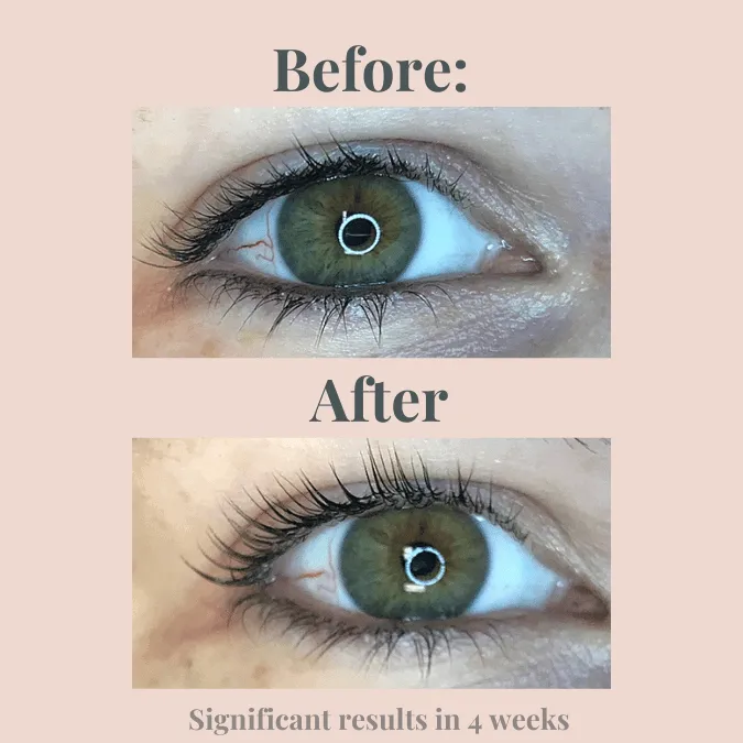 Lash & Brow Serum 5ml
